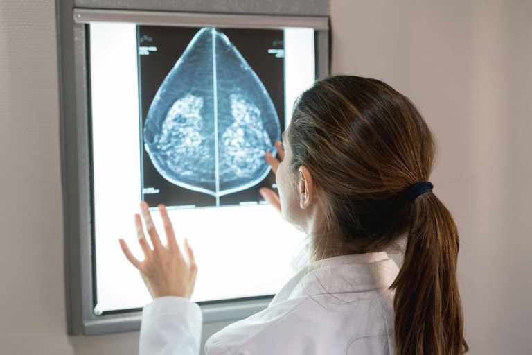 Mamografias no SUS em pacientes com menos de 50 anos representam 30% do total, equivalente a mais de 1 milhão em 2024. Foto: GettyImages