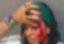 RIO: Influenciadora leva socos no rosto em roda de samba na Lapa
