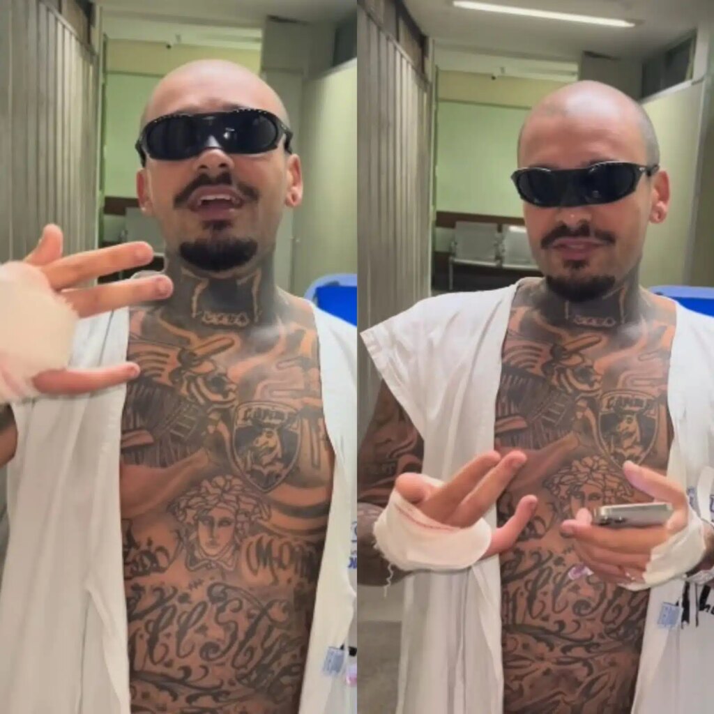 Homem tem dedo amputado ao tentar invadir ao Rock in Rio e anuncia leilão