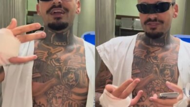 Homem tem dedo amputado ao tentar invadir ao Rock in Rio e anuncia leilão